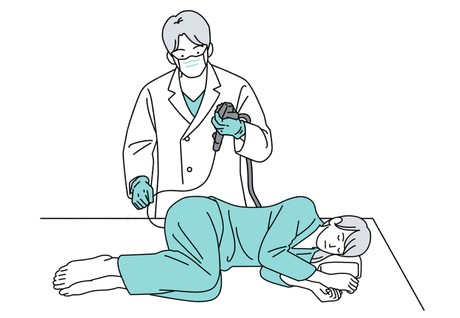 大腸内視鏡検査のイラスト