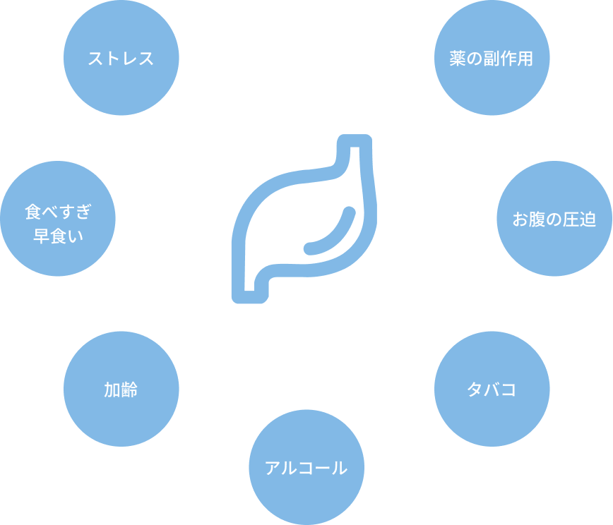 ストレス・食べすぎ、早食い・加齢・アルコール・タバコ・お腹の圧迫・薬の副作用