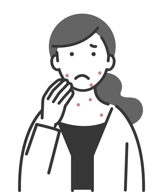 蕁麻疹の症状に悩む女性のイラスト