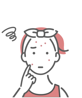 ニキビで悩む女性のイラスト